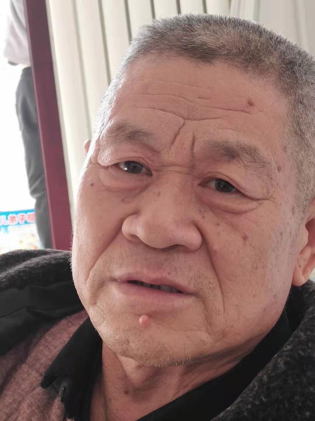 面相图解:山根有横纹会离婚
