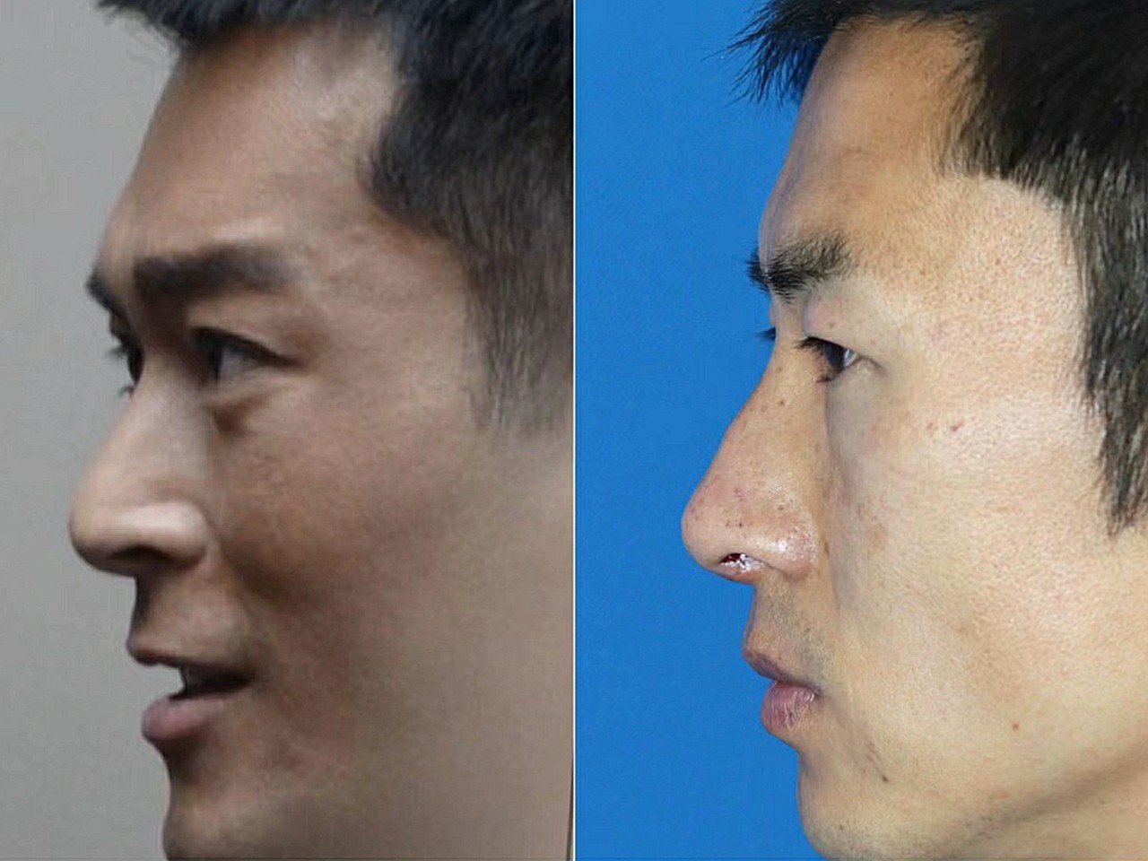 男人面相:男人天庭凹陷眉骨突出