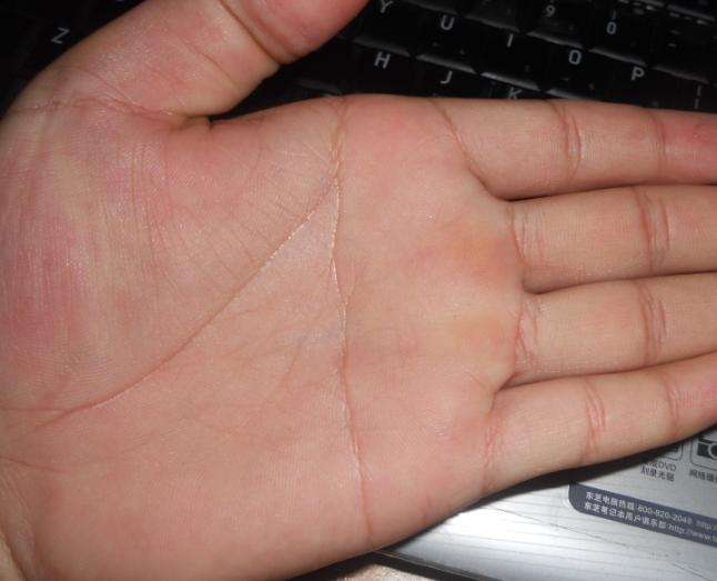 手相图:手相图解极其罕见的手相