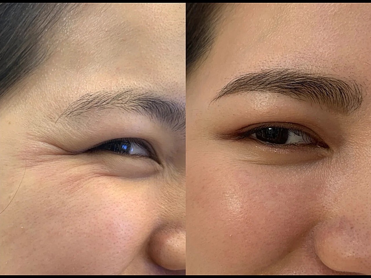 天生鱼尾纹天生鱼尾纹的命运