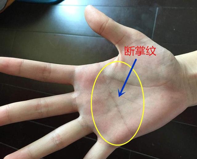 手纹断掌:什么是手纹断掌手相
