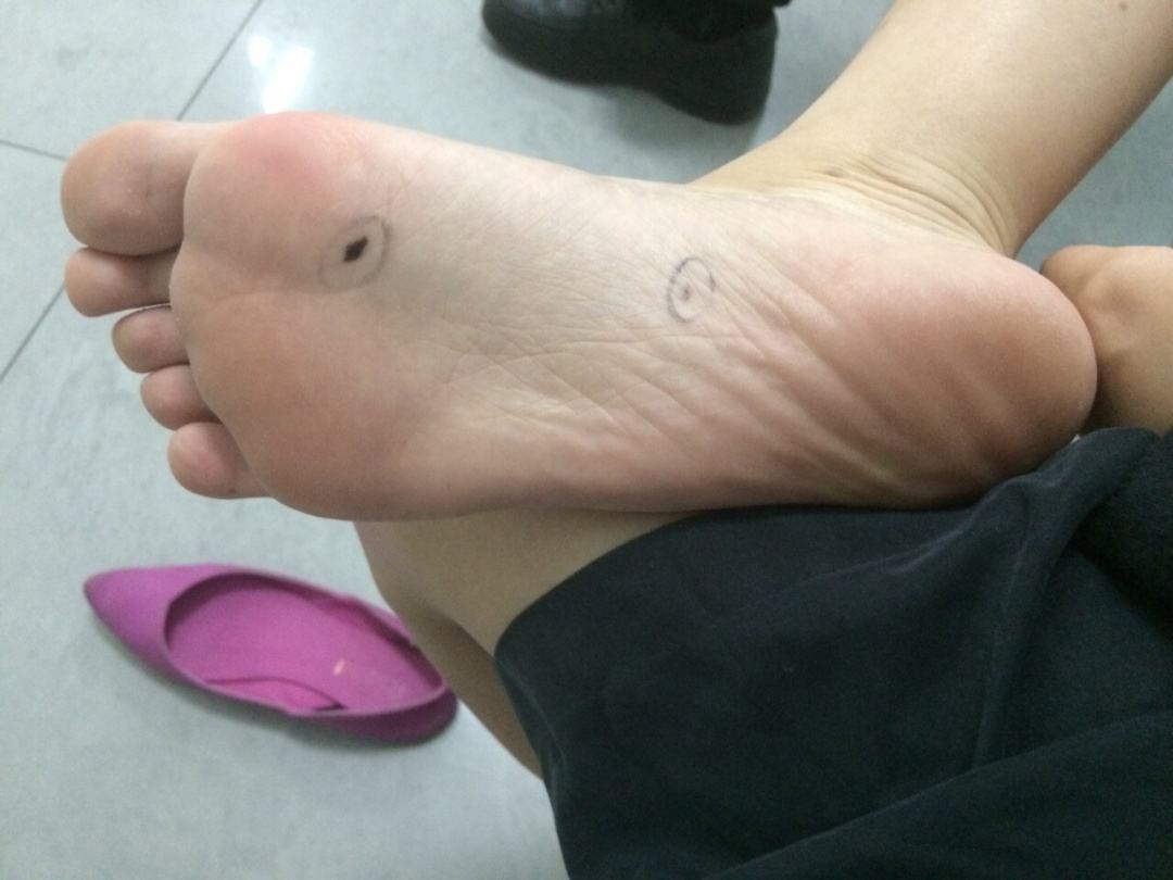 女人脚底有痣:女人脚底有痣麻衣神相