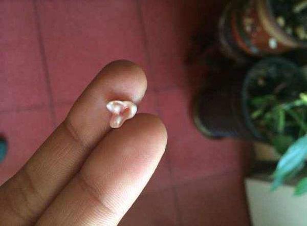 梦见自己牙掉了