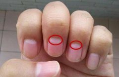 指甲上的月牙代表什么 手相图解指甲上的月牙代表什么