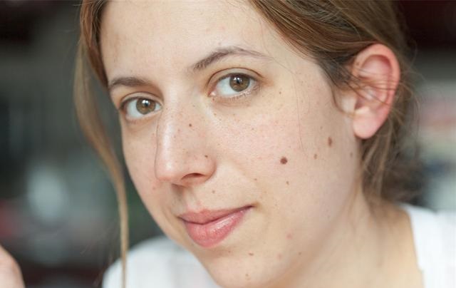 佛说脸上有很多痣的人