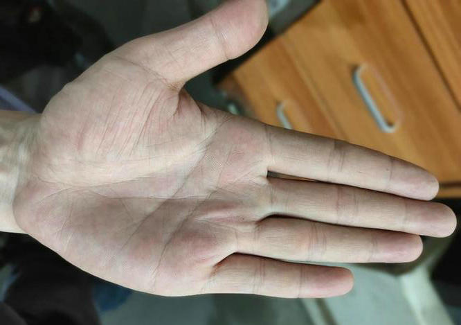 千万富翁手相特征