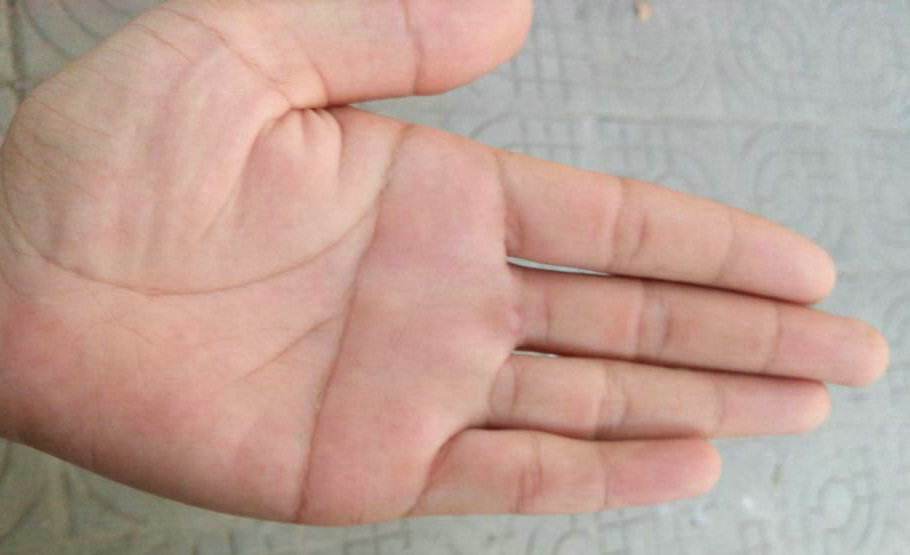 �������ͻȻ����������