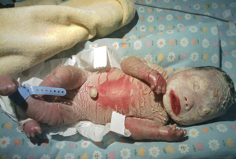 ȡ����ֲ���������Ӱ���˶�ϰ�ߺ�ְҵ��չ(ȡ����ֲ�������Ӱ���˶�ϰ��)