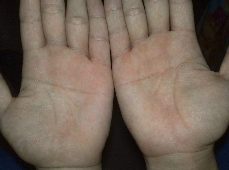 ʢ���к��������ִ�ˮ���Ի�Ӱ���������Ǳ�ڷ���(ʢ���к��������ִ�ˮ���Իᵼ�������ɥʧ������)