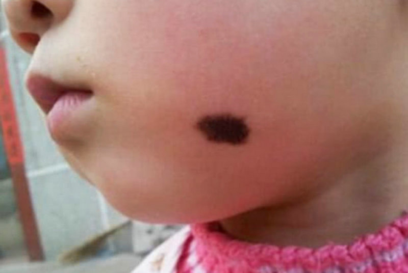 ����������ȱˮ��ô��