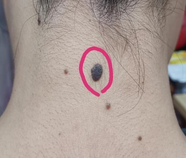 1985����ţ�ı������Ӱ���������ӵ�̬��(1985����ţ�ı������ܷ�Ӱ���������ӵ���̬�����θ�)